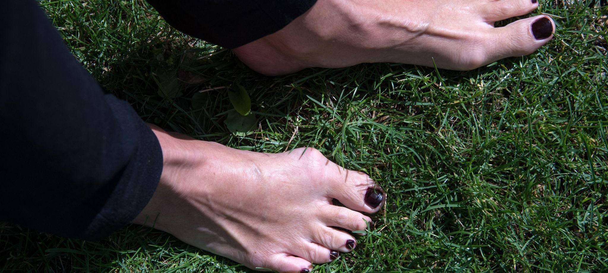 Füße einer Frau mit Zehenfehlstellung Hallux valgus